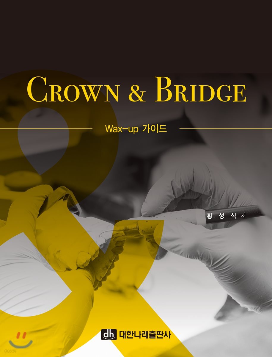 CROWN & BRIDGE - Wax-up 가이드 (Wax-up 가이드)