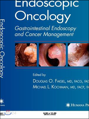 Endoscopic Oncology (Gastrointestinal Endoscopy And Cancer Management)
