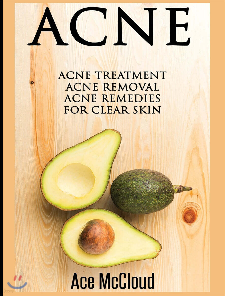Acne (Acne Treatment: Acne Removal: Acne Remedies for Clear Skin)