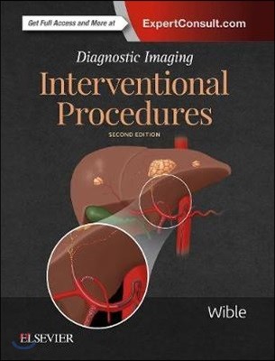Diagnostic Imaging (Interventional Procedures)