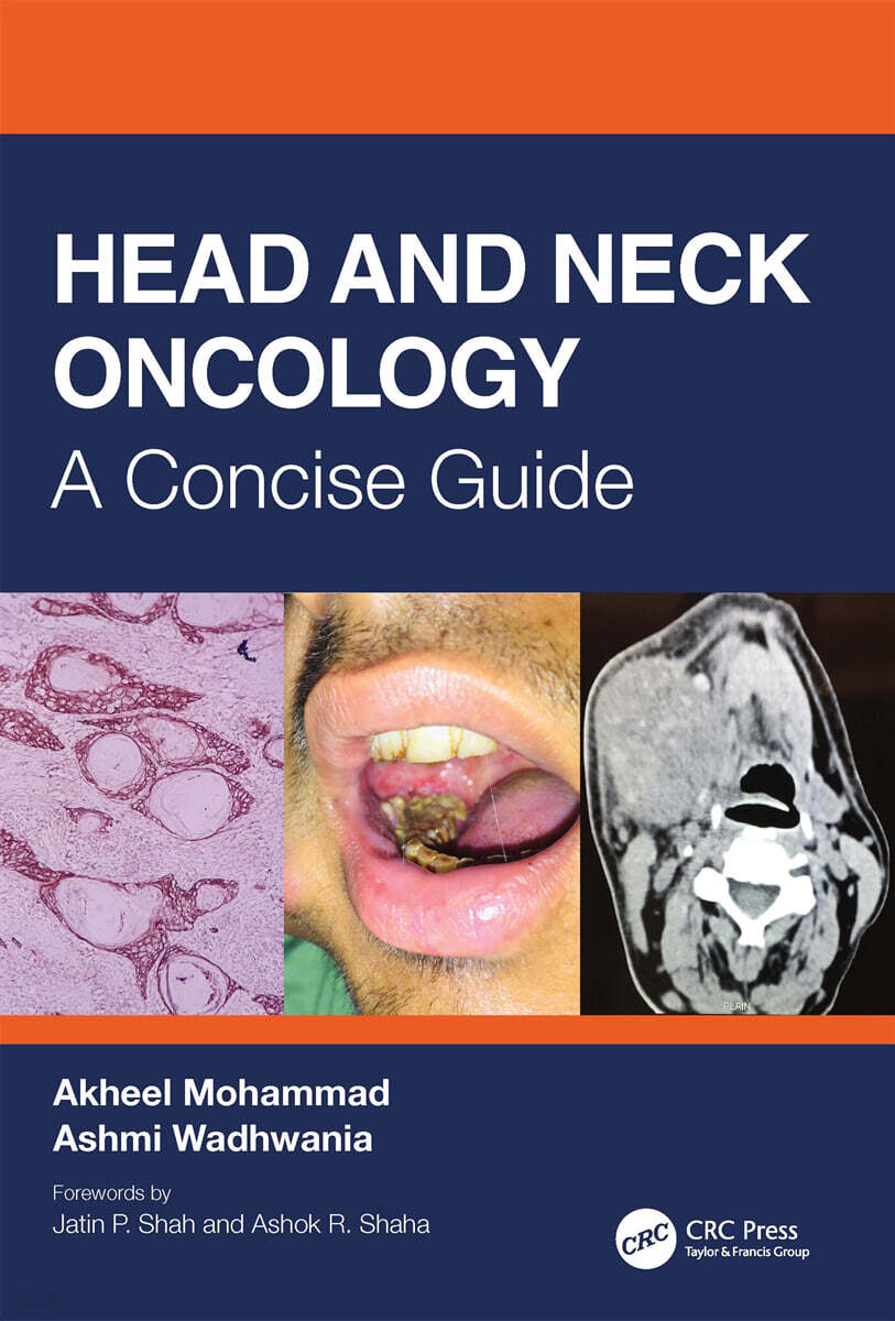 Head and Neck Oncology (A Concise Guide)
