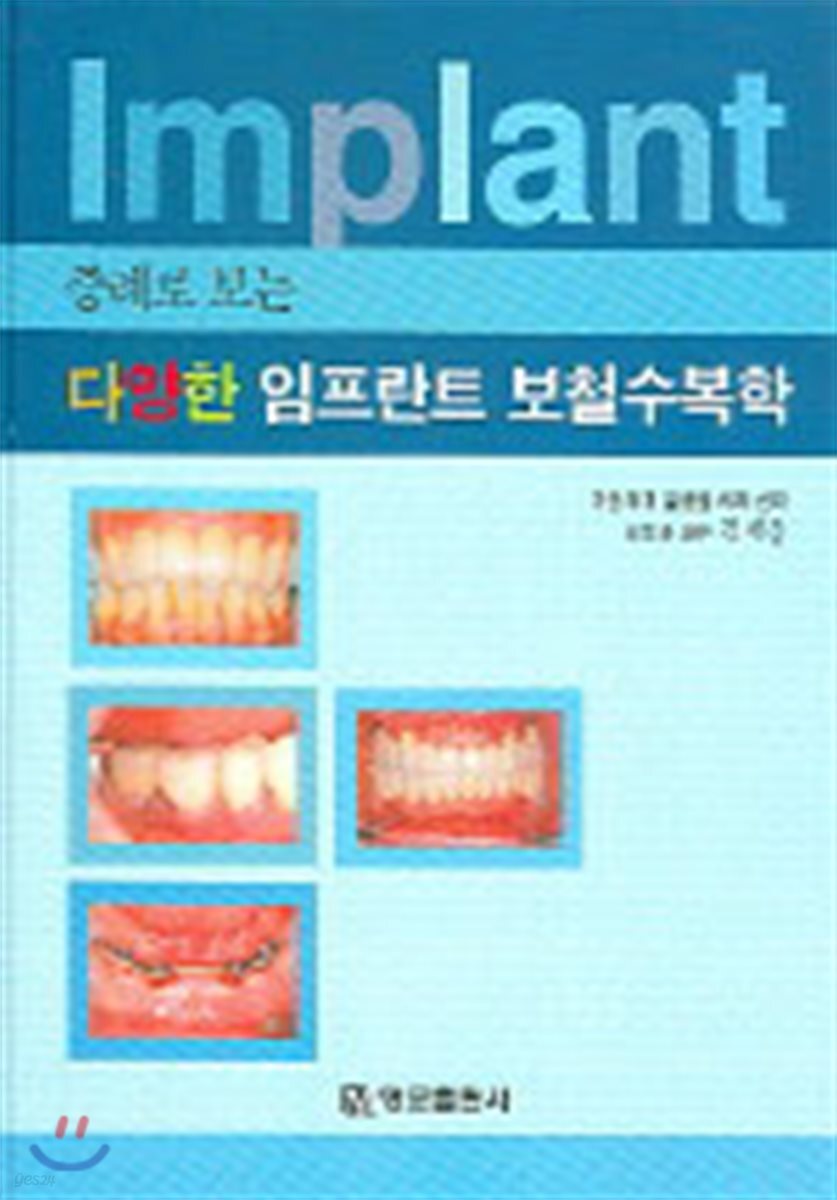 (증례로 보는)다양한 임프란트 보철수복학 = Implant prosthodontics