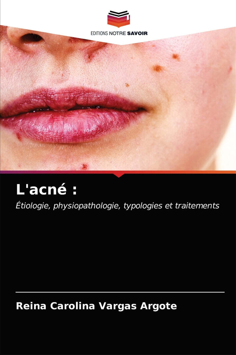 L’acne