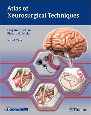 Atlas of Neurosurgical Techniques (Brain)