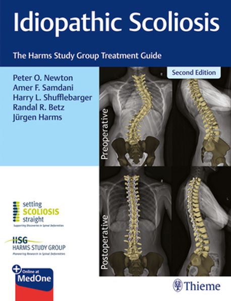 Idiopathic Scoliosis: The Harms Study Group Treatment Guide, 2/E