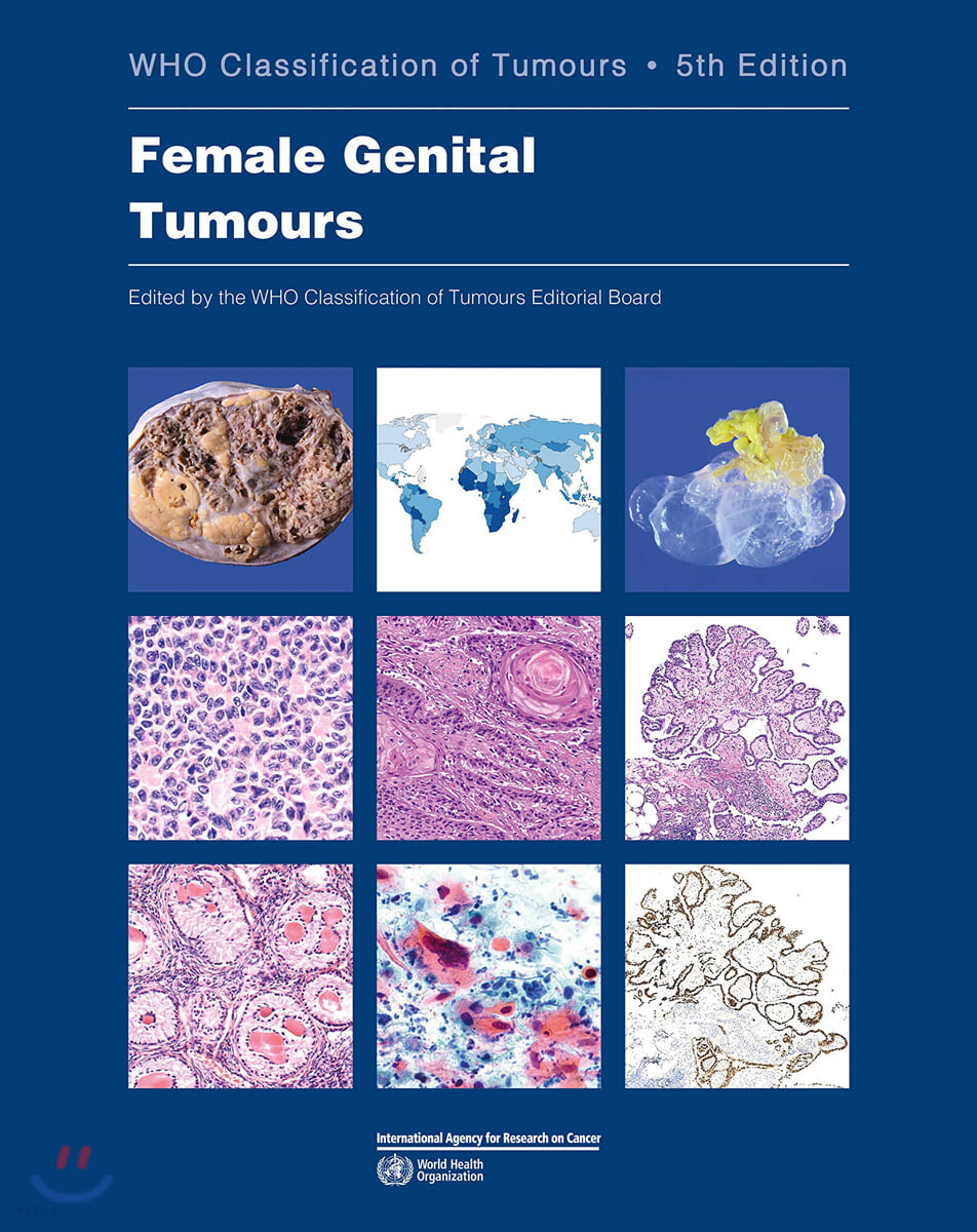 Female Genital Tumours: Who Classification of Tumours (World Health Organization Classification of Tumours)