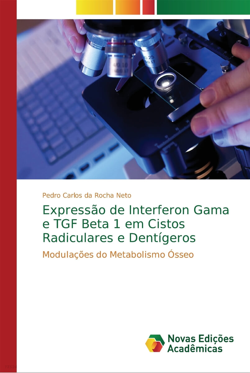 Expressao de Interferon Gama e TGF Beta 1 em Cistos Radiculares e Dentigeros