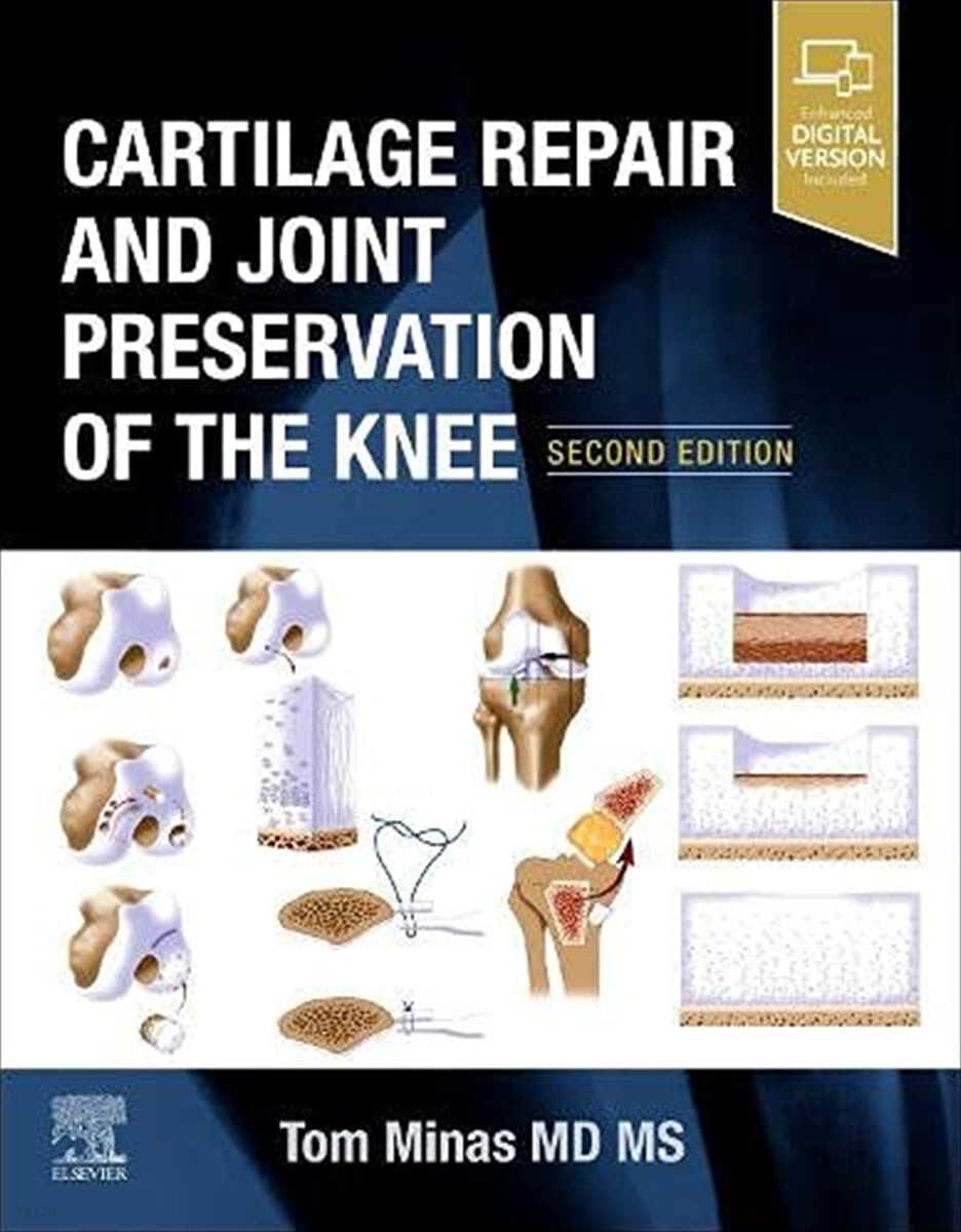 Cartilage Repair and Joint Preservation of the Knee, 2/E