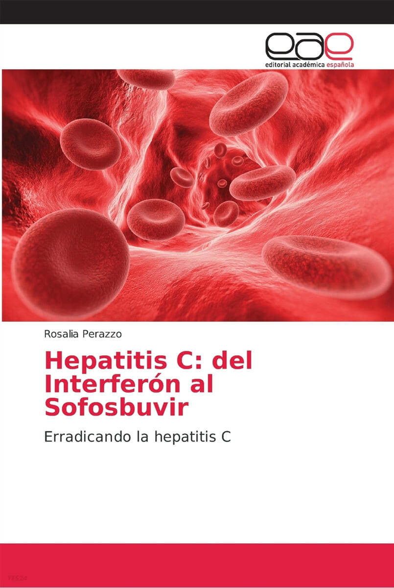 Hepatitis C: del Interferon al Sofosbuvir
