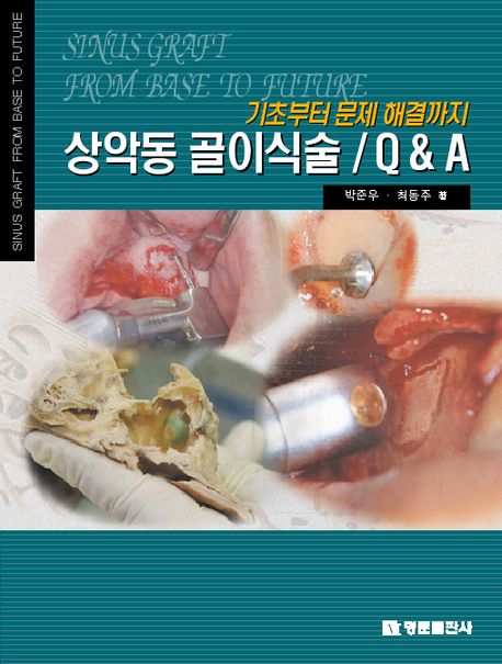 (기초부터 문제 해결까지)상악동 골이식술 = Sinus graft from base to future : Q▼A