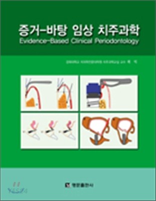 (아트라스)증거-바탕 임상 치주과학 = Evidence-based clinical periodontology