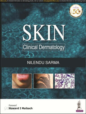 Skin (Clinical Dermatology)