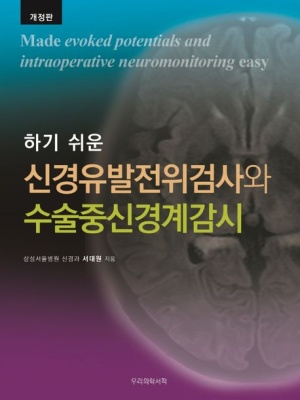 하기 쉬운 신경유발전위검사와 수술중신경계감시