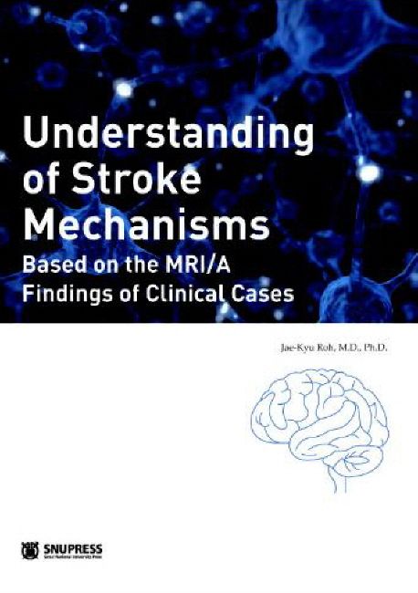 Understanding of stroke mechanisms  : based on the MRI/A findings of clinical cases
