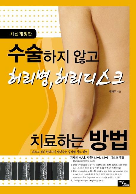 수술하지 않고 허리병, 허리디스크 치료하는 방법 디스크 걸린 한의사가 알려주는 증상별 치료 해법 큰글자도서