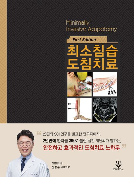 최소침습 도침치료  = Minimally invasive acupotomy