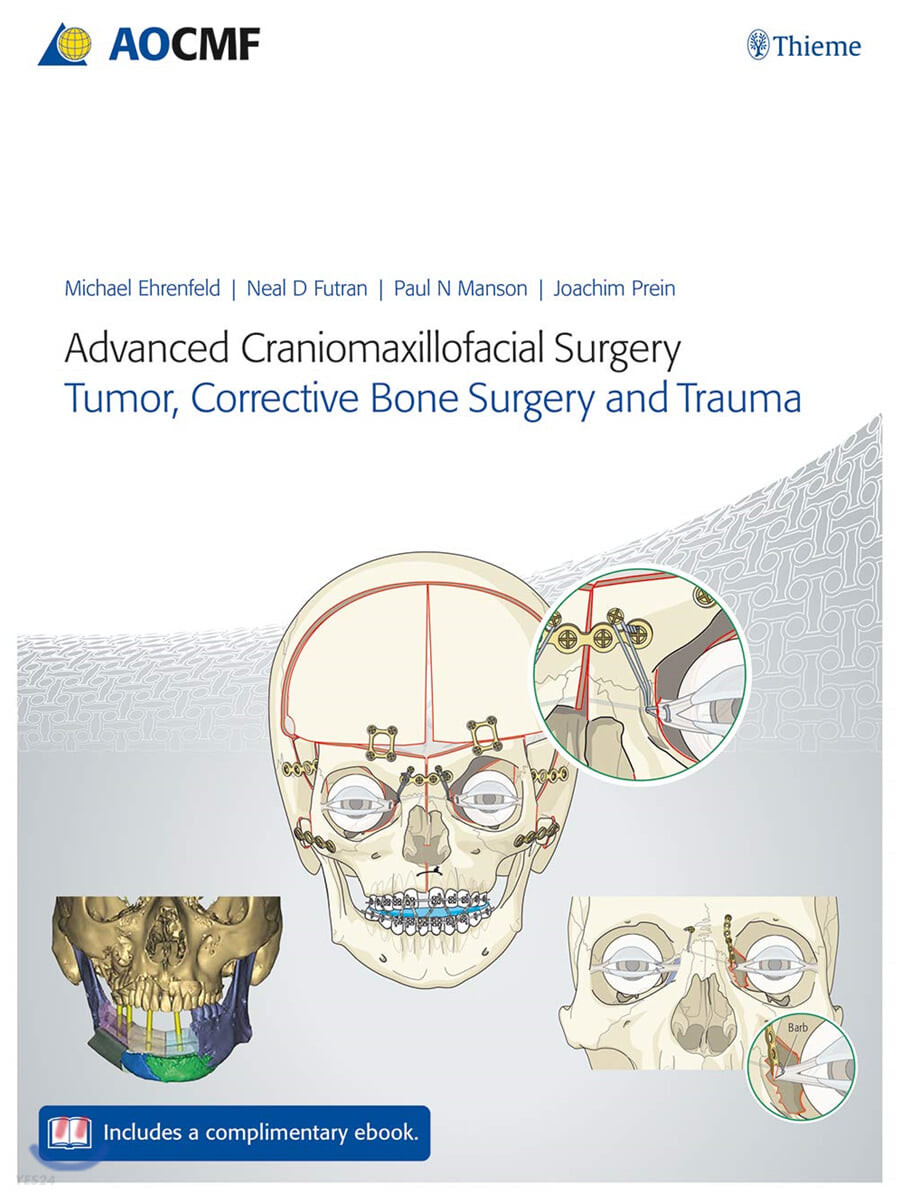 Advanced Craniomaxillofacial Surgery (Tumor, Corrective Bone Surgery, and Trauma)