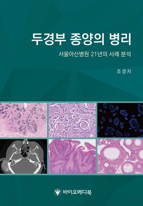 두경부 종양의 병리 (서울아산병원 21년의 사례 분석)