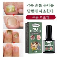 1+1 손톱 조갑박리증치료제 무 좀 치료제 풀케어 발무 약 조갑사상균증 진균 리페어에센스 발톱 약 30ml