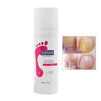 Footlogix 풋로직스 발톱영양제 발케어  안티 펑거 발톱 스프레이 50ml