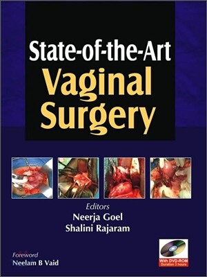 State-Of-The-Art Vaginal Surgery