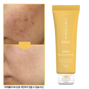 1+1 여드름 모공 각질 노폐물 제거 호호바 9000 딥클렌징폼