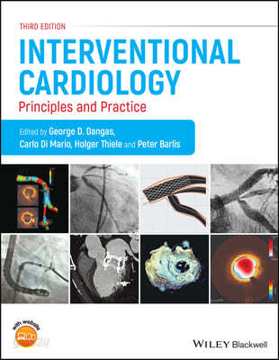 Interventional Cardiology (Principles and Practice)