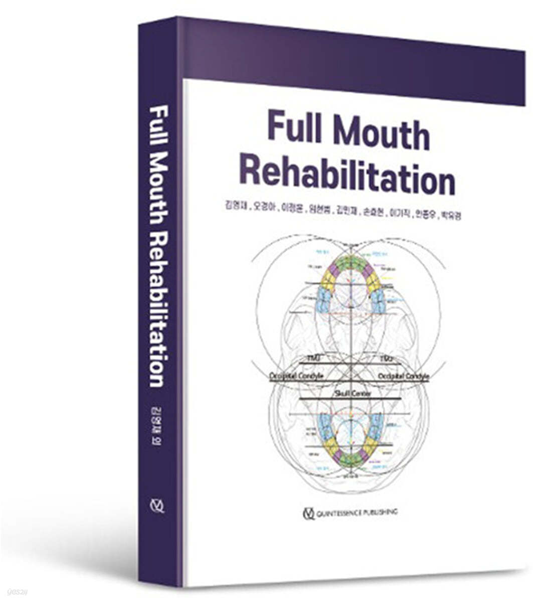 Full mouth rehabilitation