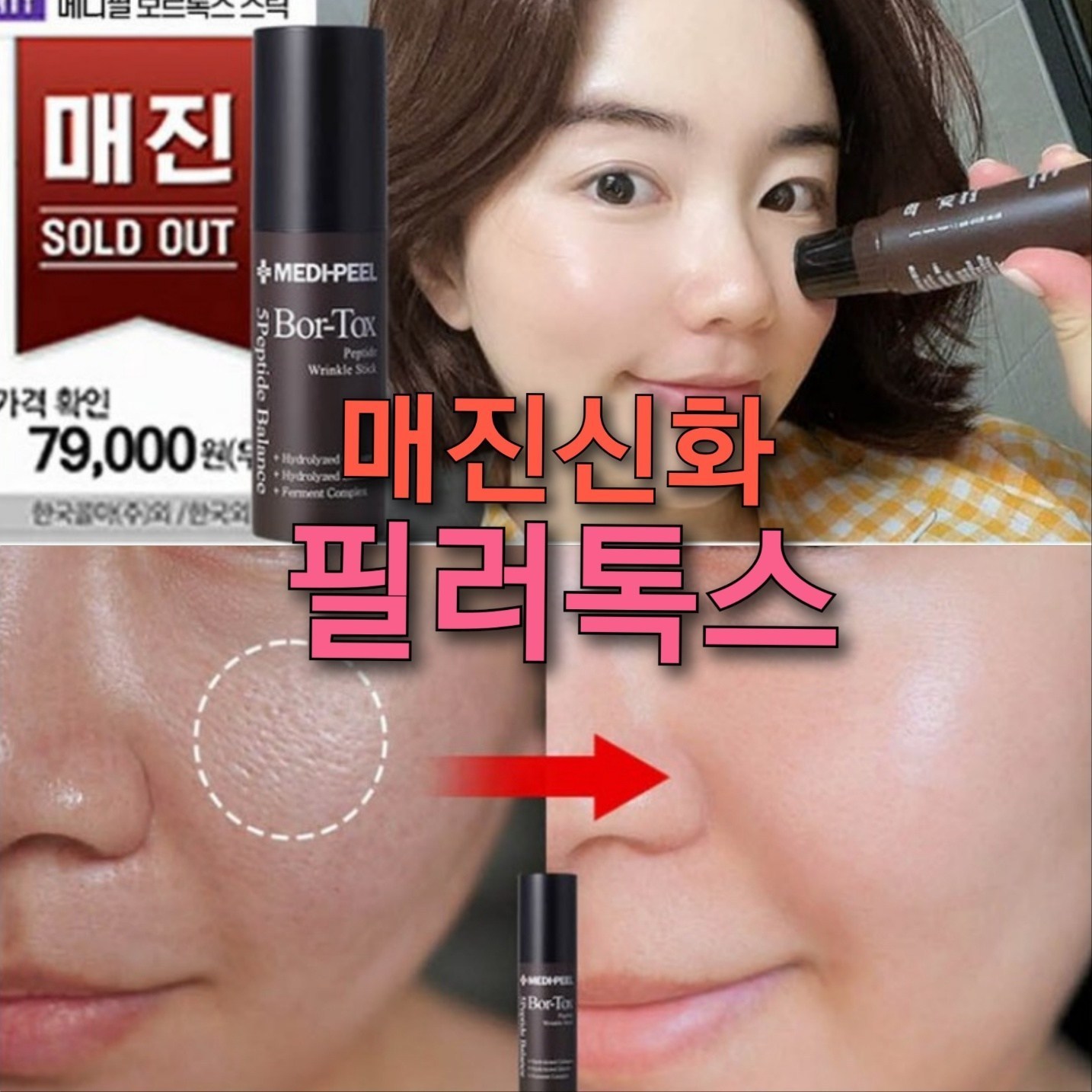 보톡스 <b>콜라겐</b>뿌리 보톡 볼륨 <b>필러</b>스틱  10g  2개