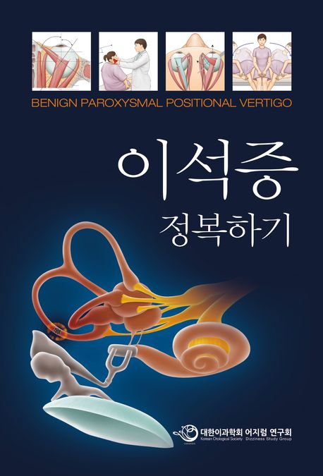 이석증 정복하기=Benign paroxysmal positional vertigo