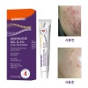 dermfree