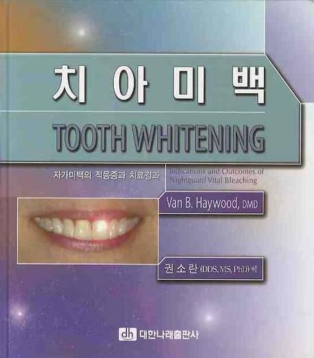 치아미백