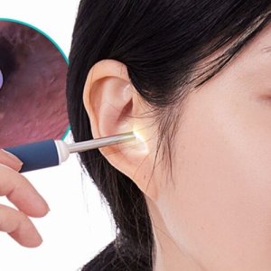 [내시경귀이개] 1천만 화소가 보여주는 속시원함│무선 내시경 귀이개