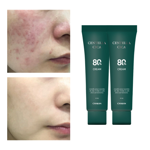 시카 트러블 피부과 탄력 영양 재생 보습 수분 크림 <b>병풀 센텔라</b>  50ml  2개