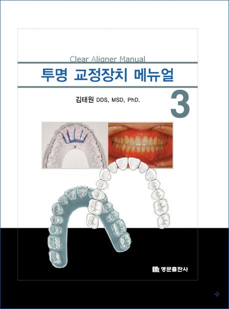 투명 교정장치 메뉴얼 = Clear aligner manual. 3