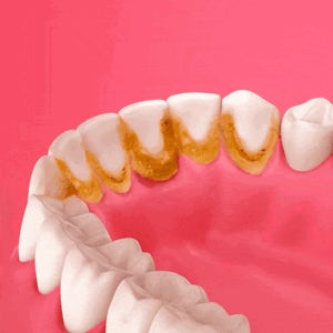 (한정판매) 치밍아웃 셀프 치아 구강 청결기 GT-1002