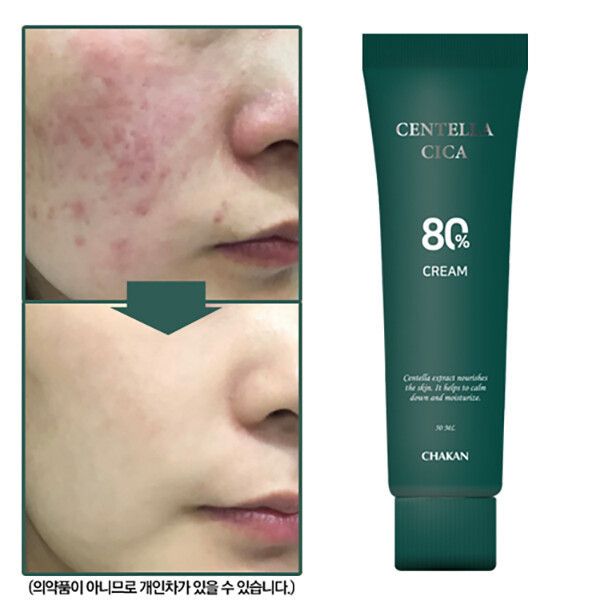 매일관리 시카 트러블 피부과 탄력 영양 재생 보습 수분 크림 <b>병풀 센텔라</b> 1 케어990937