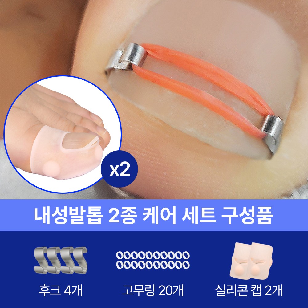 [<b>아임</b>봄] 파고드는 엄지<b>발톱</b> 보정기  1개  화이트