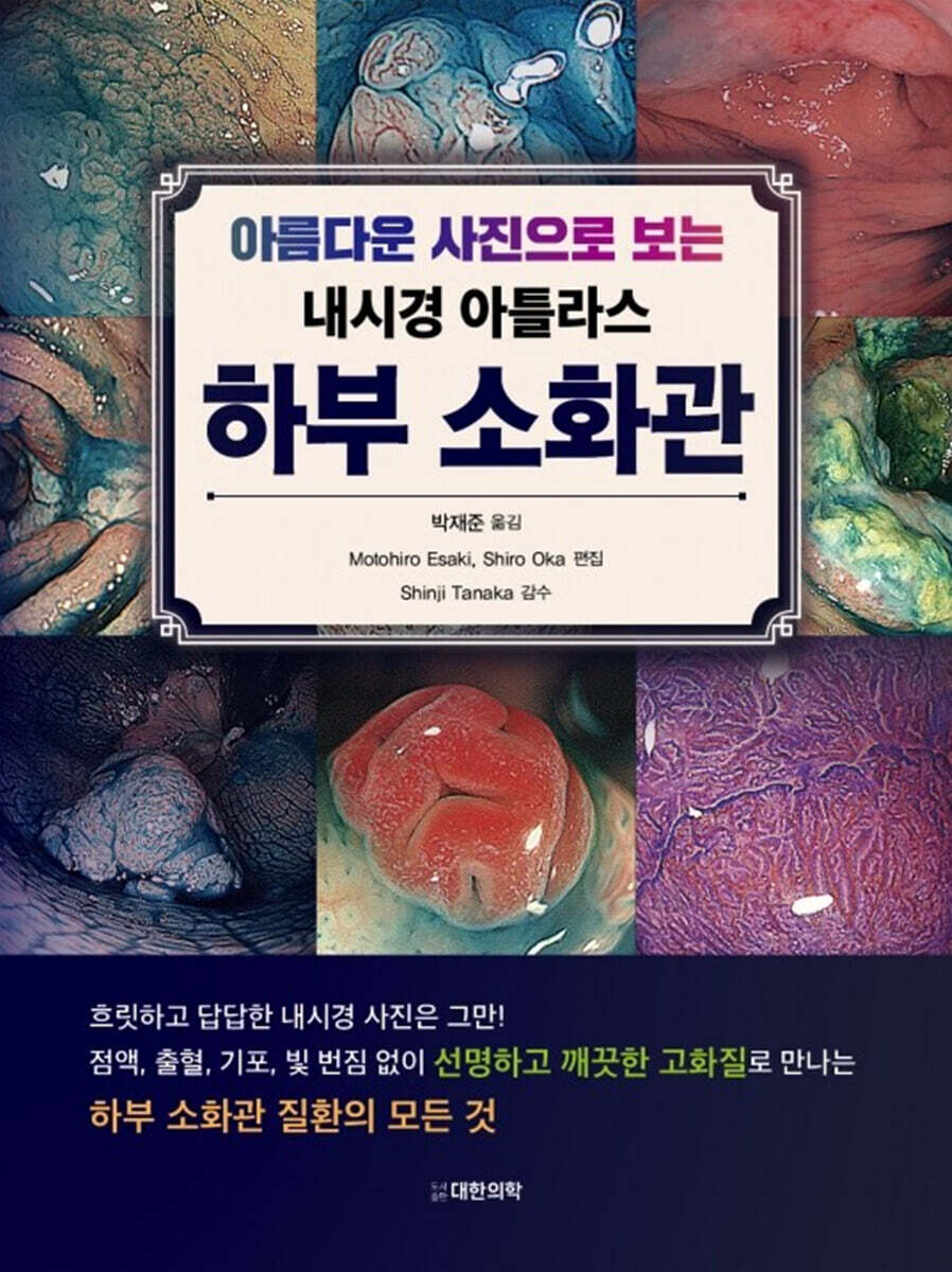 (아름다운 사진으로 보는 내시경 아틀라스) 하부 소화관