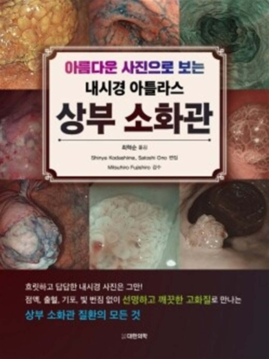 (아름다운 사진으로 보는 내시경 아틀라스) 상부 소화관