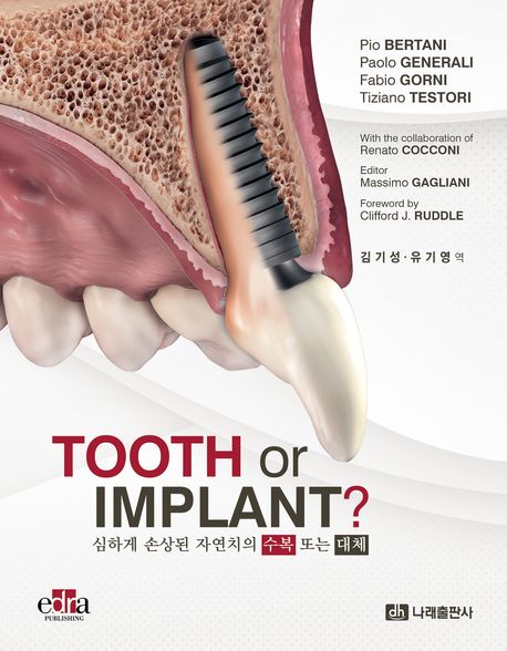 Tooth or Implant? : 심하게 손상된 자연치의 수복 또는 대체