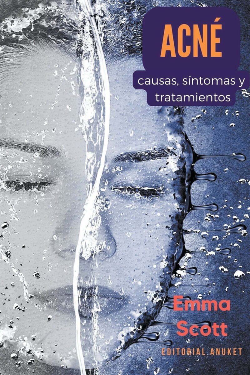 Acne (Causas, Sintomas y Tratamientos)