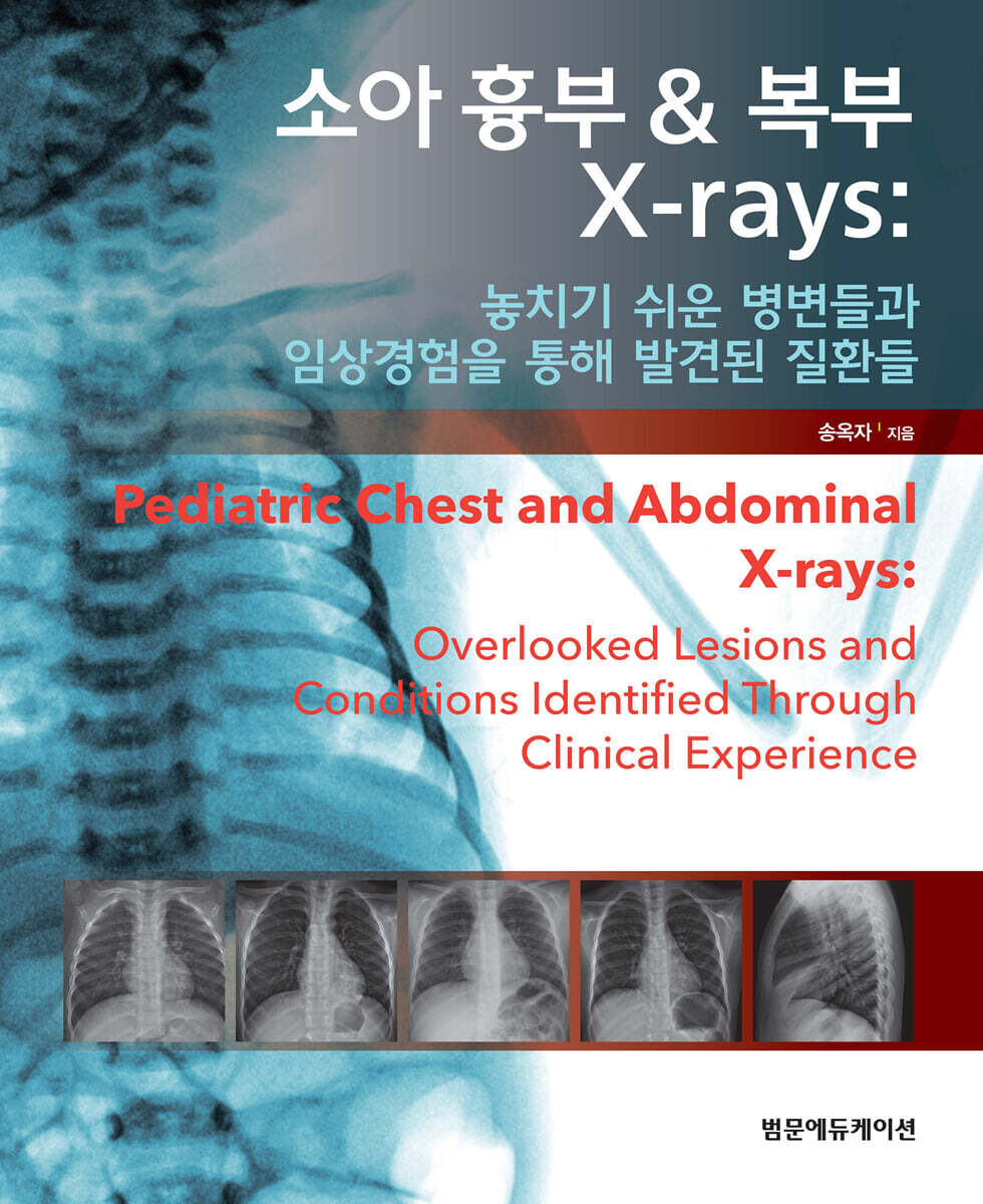 소아 흉부 & 복부 X-rays : 놓치기 쉬운 병변들과 임상경험을 통해 발견된 질환들 = Pediatric chest and abdominal X-rays : overlooked lesions and conditions identified through clinical experience