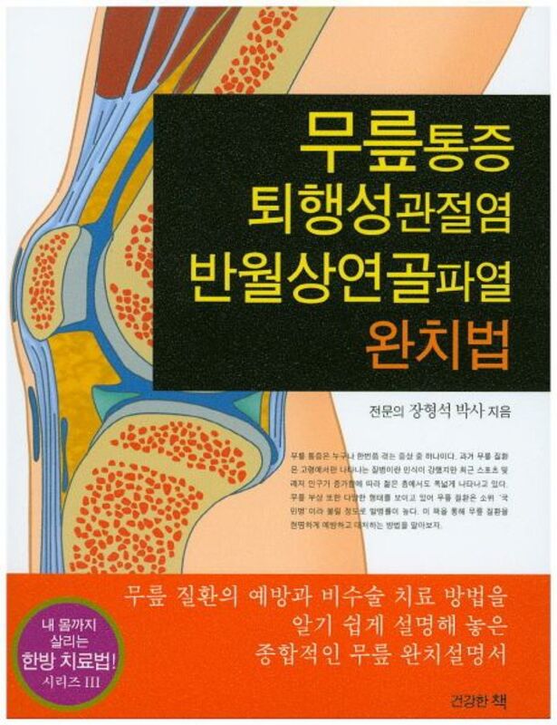 무릎통증 <b>퇴행성관절염</b> 반월상연골파열 완치법