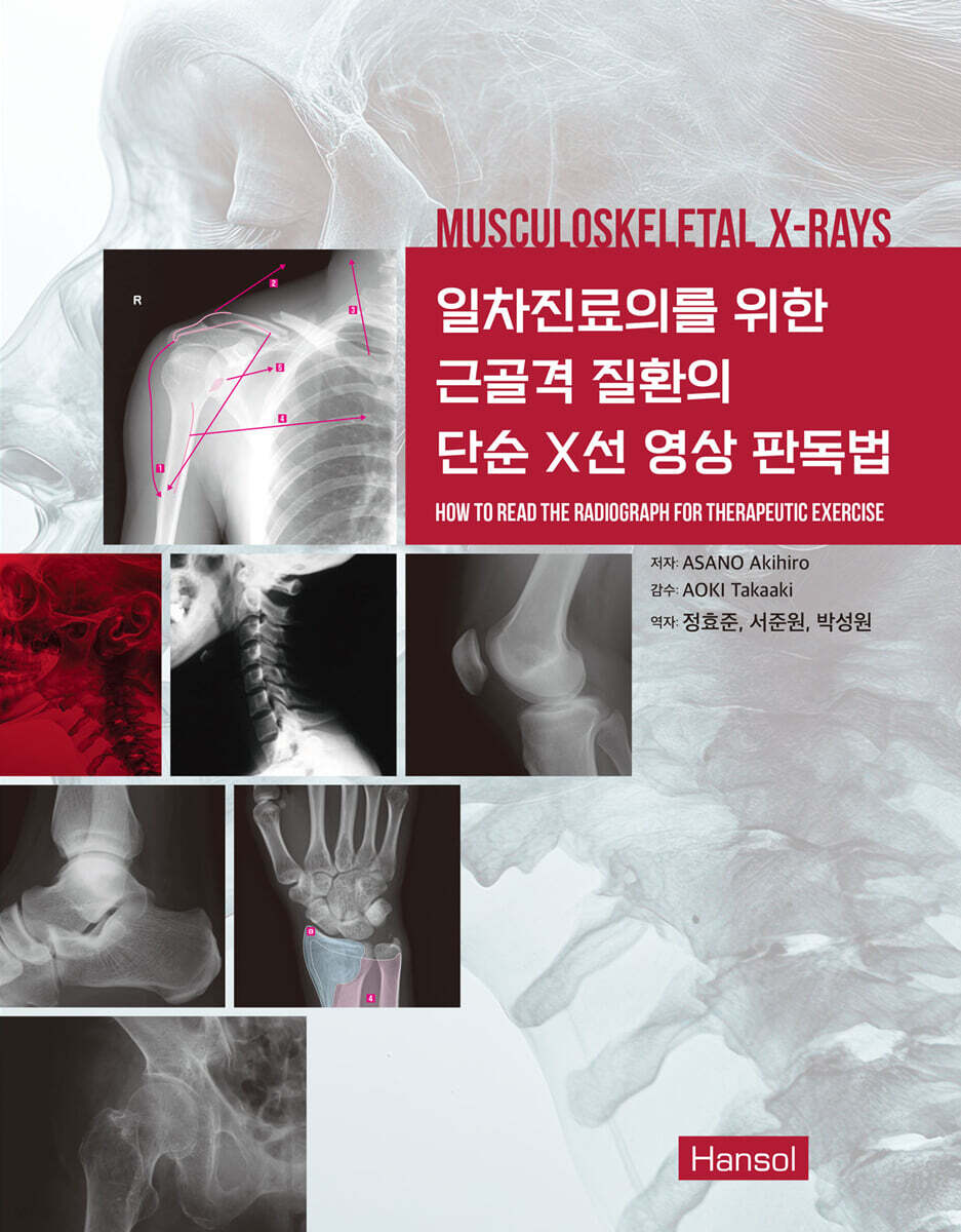 (일차진료의를 위한) 근골격 질환의 단순 X선 영상 판독법 = Musculoskeletal X-rays: how to read the radiograph for therapeutic exercise