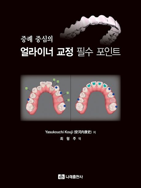 증례 중심의 얼라이너 교정 필수 포인트