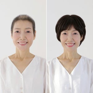 암환자 항암가발볼륨 숏컷 스타일 인모 블렌딩