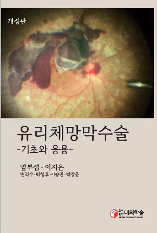 유리체망막수술 :기초와 응용