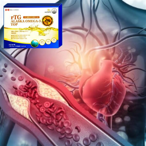 rTG 알래스카 오메가-3 탑