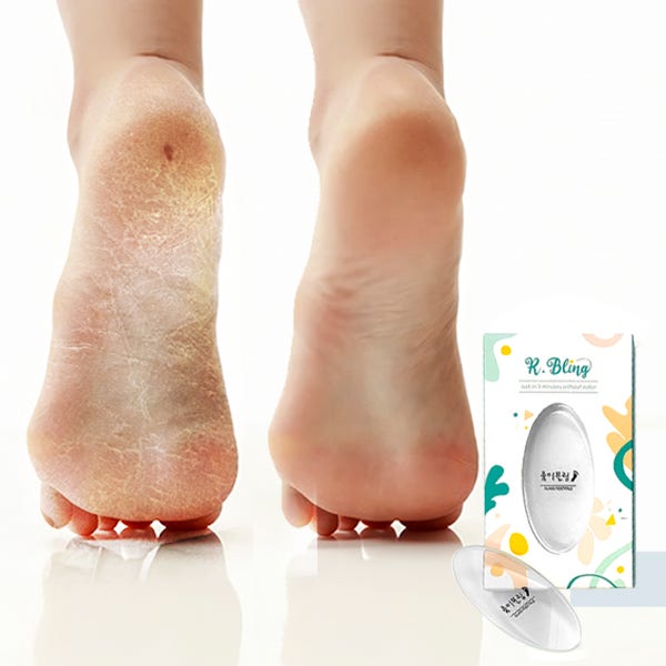 발 각질 제거기 발바닥 굳은살제거 발꿈치 뒤꿈치 룸이블링 유리 글라스풋파일